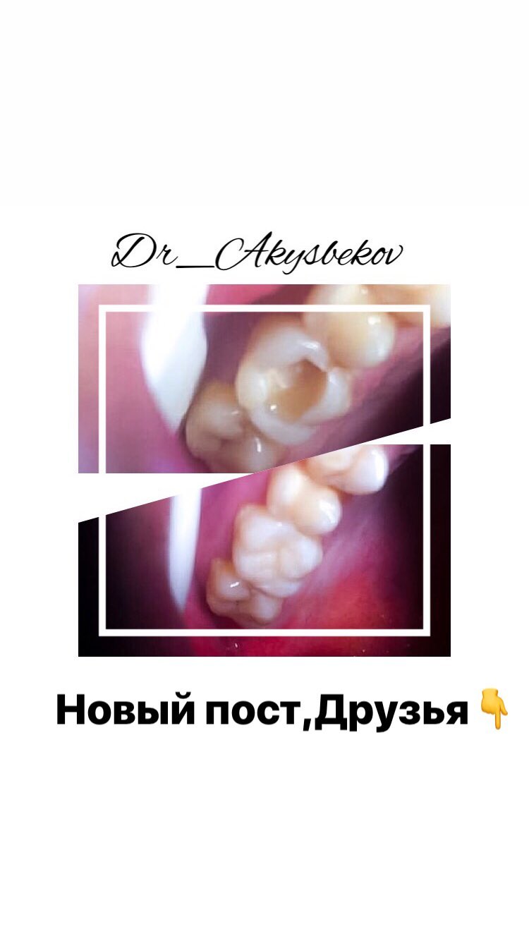 Лечение дисфункции ВНЧС