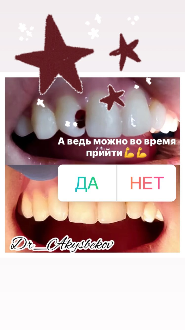 Лечение дисфункции ВНЧС